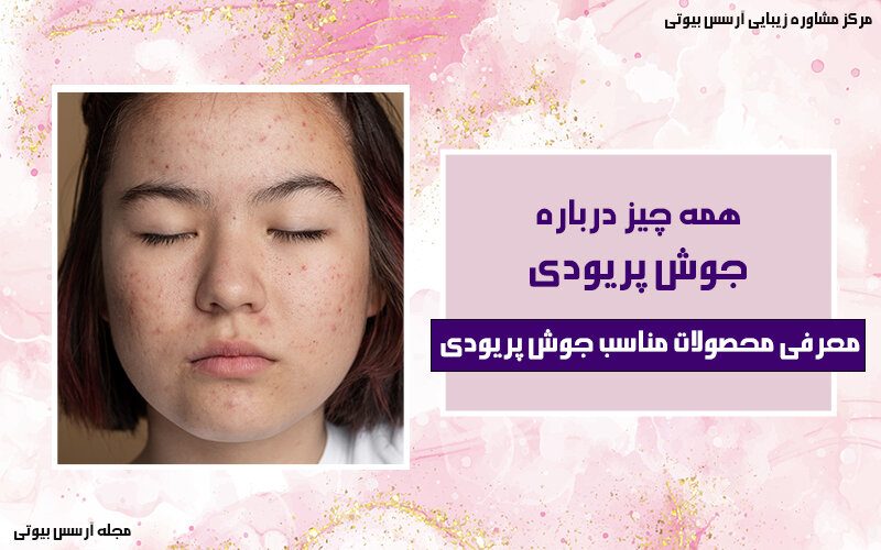 همه چیز درباره جوش پریودی