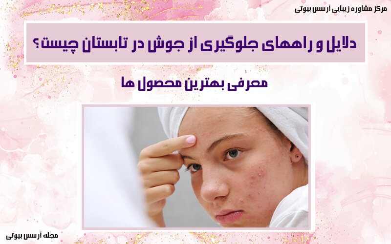 دلایل جوش در تابستان
