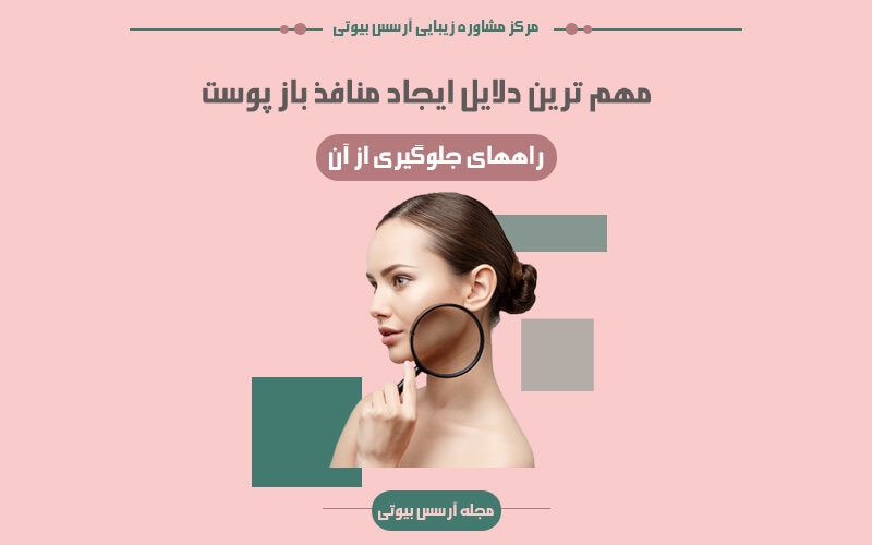دلایل ایجاد شدن منافذ باز پوست