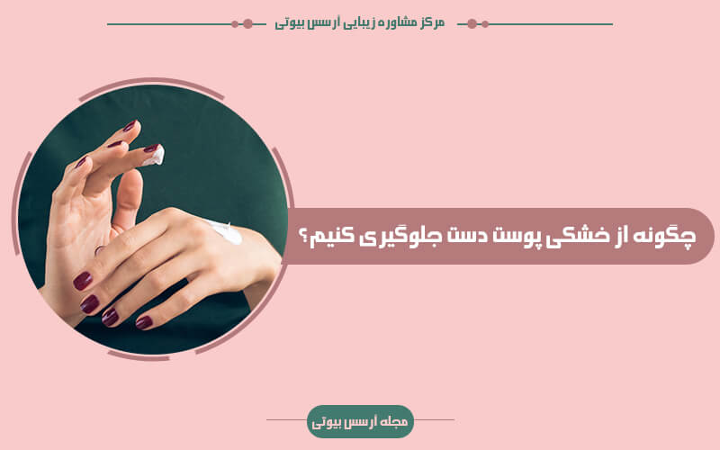 جلوگیری از خشکی پوست دست