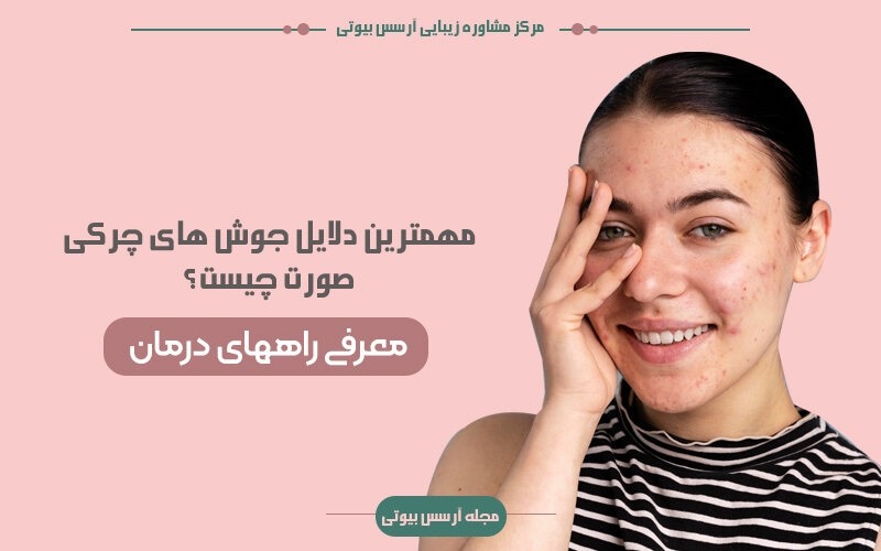 دلایل جوش های چرکی